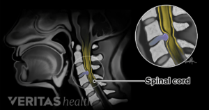 Zoomed image of the spinal cord region.