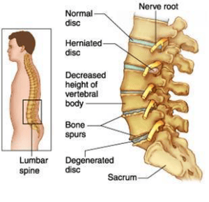 Resized image of comparison of human spine vertebrae with Lumbar spine.