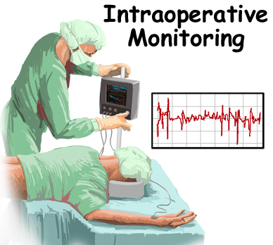 Image describes neuromonitor for the spine.
