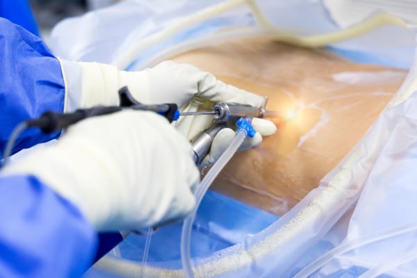 Doctor performing minimal invasive endoscopic keyhole spine surgery.