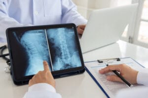 A doctor is in the process of examining an X-ray image and is about to write a report.