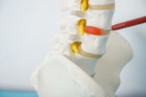 Image of the lower back model of the spine.