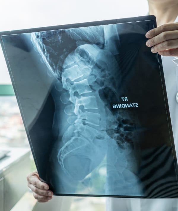 A doctor is analyzing a spine x-ray.