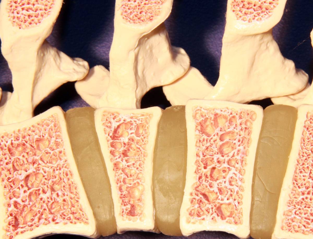 The cross-section model of the spine.