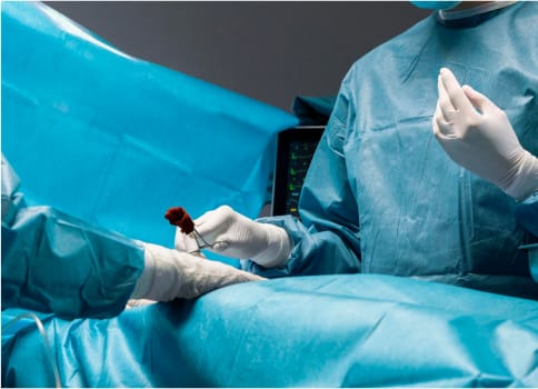A team of spine surgeons performing a minimally invasive spine procedure.